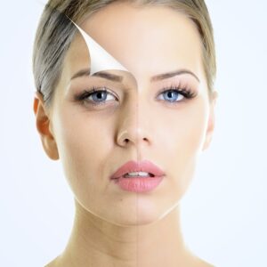 rejuvenecimiento facial sin cirugía