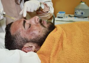 vampiro facial 1