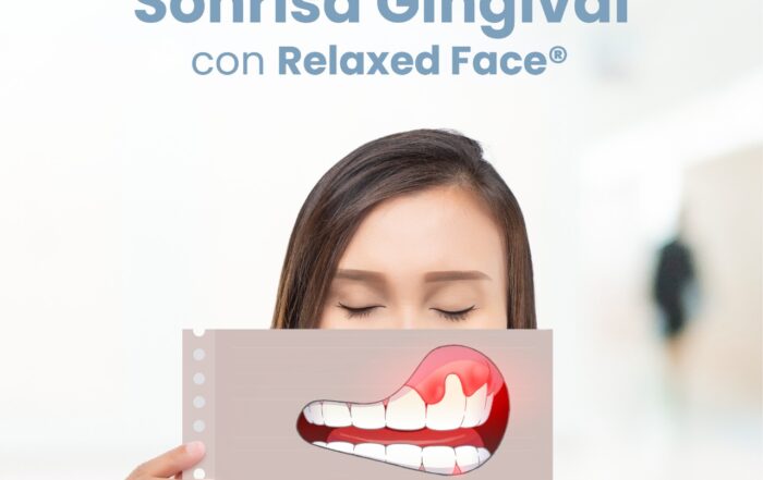 Como mejorar mi sonrisa y encías sonrisa gingival