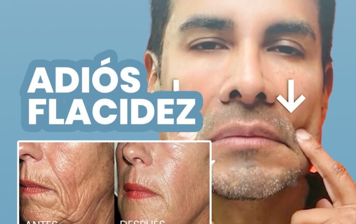 Tratamiento efectivo para rostro caído y flácido